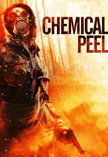 Chemical Peel poster
