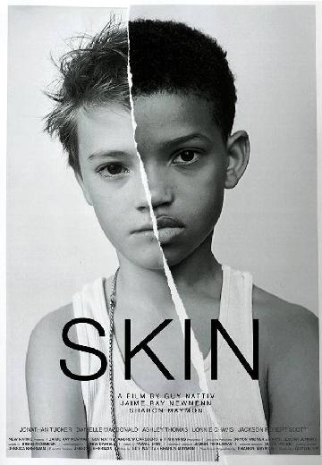Skin poster